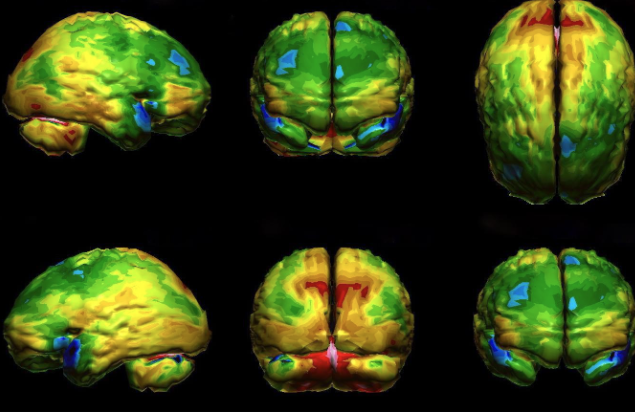 <p>single photon emission computed tomography </p><ul><li><p>3D nuclear imaging test </p></li><li><p>computer is used to create cross sectional pictures of parts of the body </p></li><li><p>good for stress test imaging </p></li></ul><p></p>
