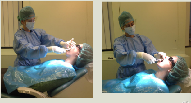 <p>lhs - removing upper left tooth </p><p>rhs - </p>