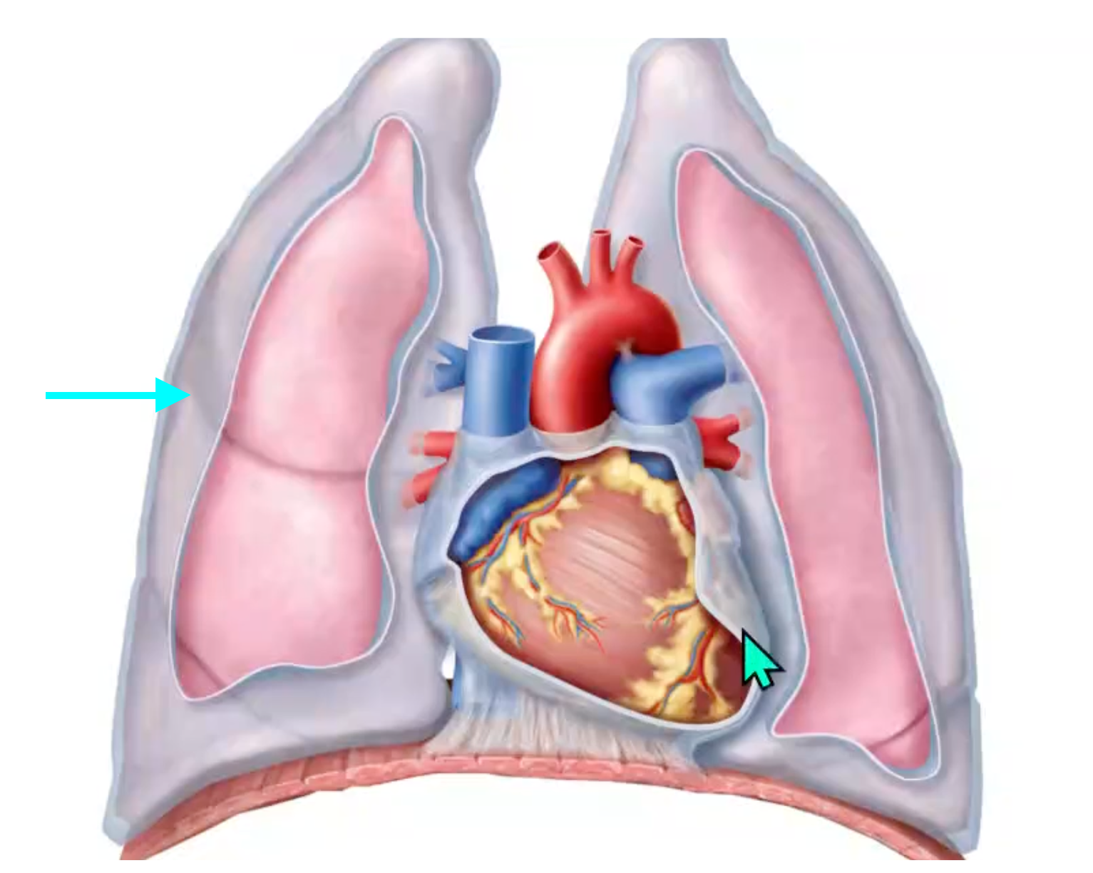 term image