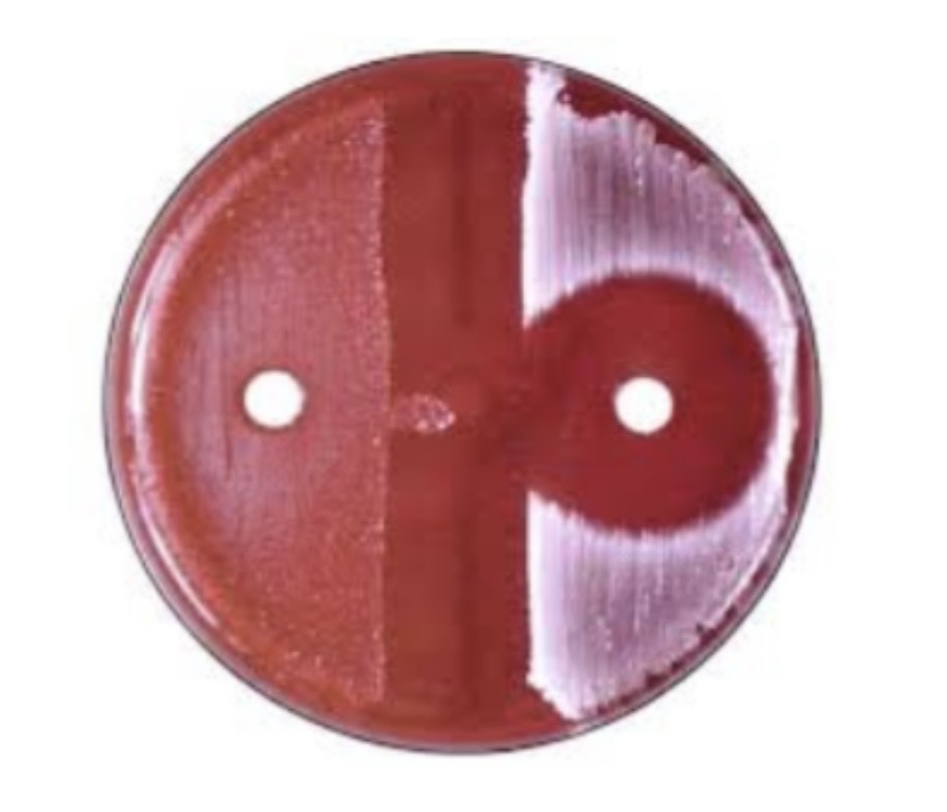 <p>The Organism that can be identified is Streptococcus pyogenes</p><p>A. What media is used for inoculation? </p><p>B. What Antibiotic was used? </p><p>C. Which side shows its Streptococcus pyogenes? </p>