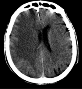 <p>what is the diagnosis?</p>