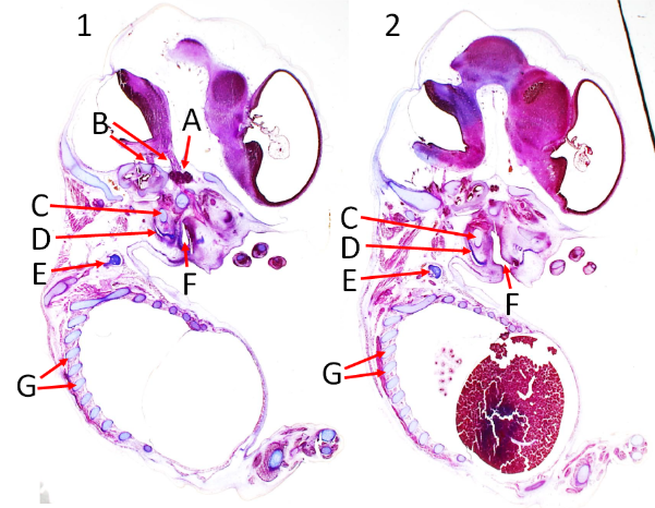 <p>Label A, B, C, D, E, F and G</p>