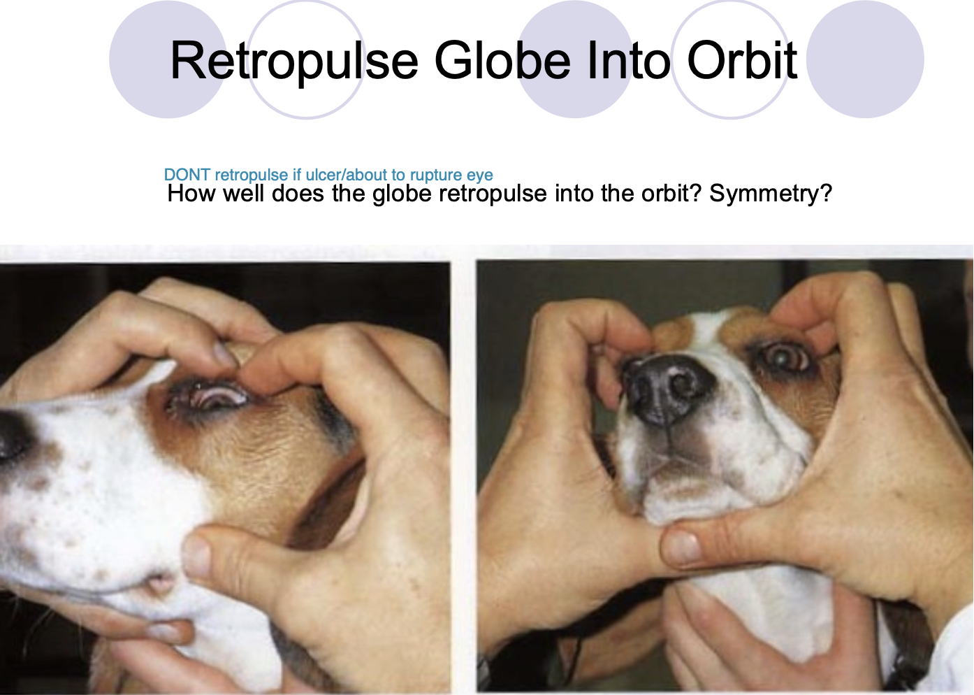 <p>Retropulsion of the globe.</p><p>Examine PO cavity at the end of the exam (b/c it can be painful)</p>