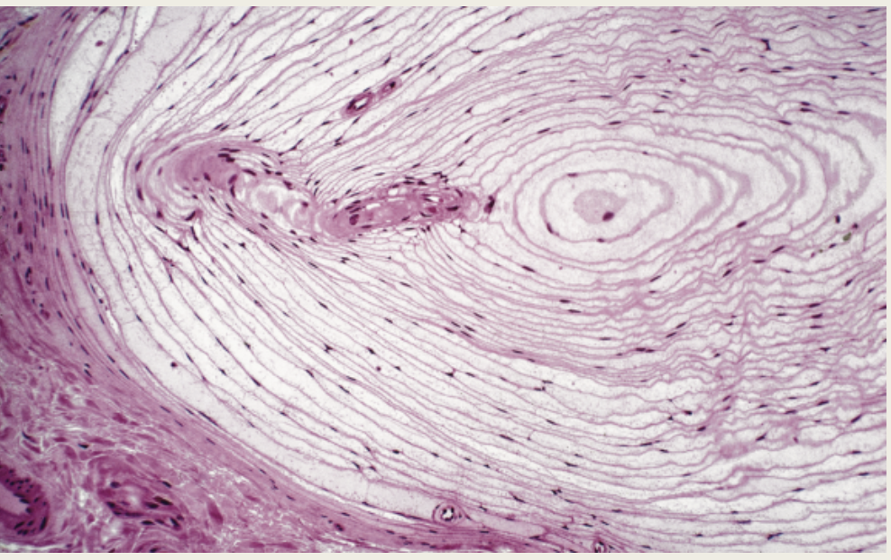 <p>Deep Touch</p><p></p>