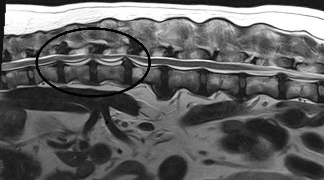 <p>MRI (in IVDD Diagnosis)</p>