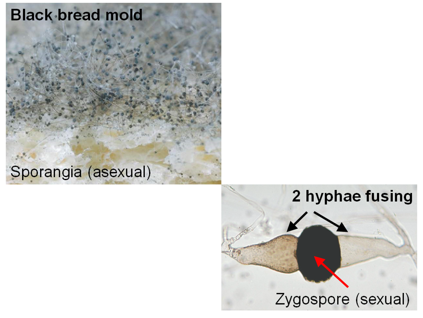<p>Zygosporangia</p>