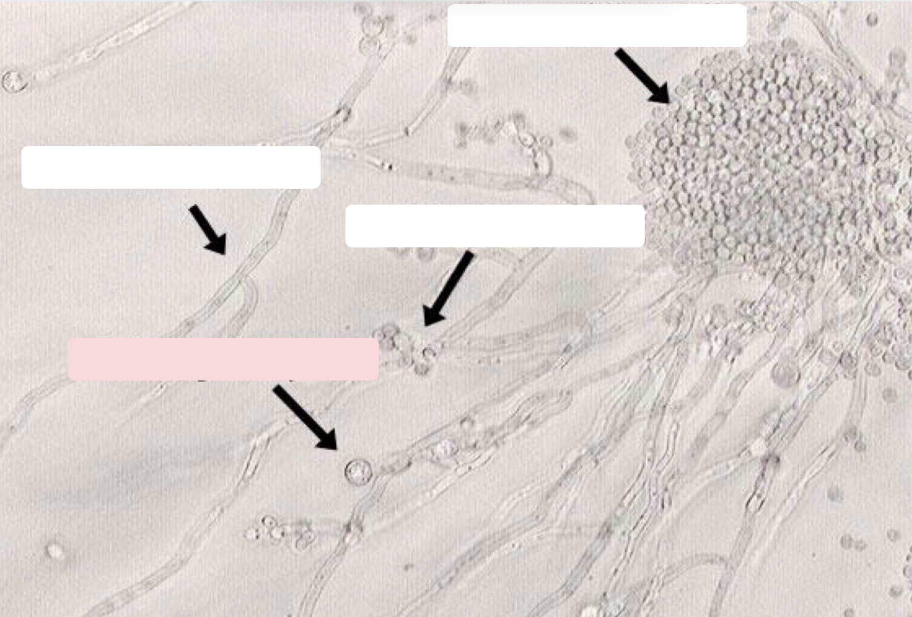 <p>Identify the C. albican Structure </p>