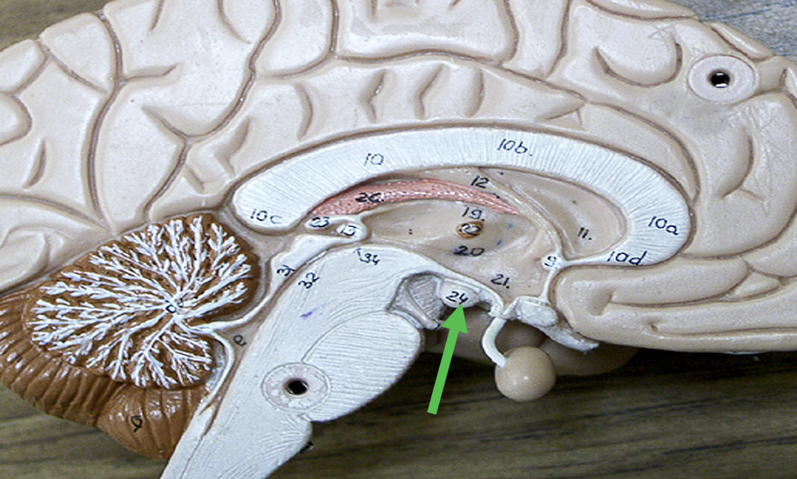 <p><span>Identify the area of the brain indicated by the pointer.</span></p>