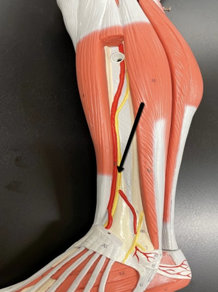 <p><span>Identify the nerve/cord indicated by the pointer.</span></p>