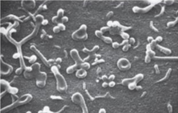 <p><em>mycoplasma </em>species:</p><ul><li><p>have extremely variable shape</p></li><li><p>antimicrobial directed towards cell wall ineffective: penicillin, lysozyme</p></li><li><p>sterols in membrane give strength to membrane </p></li></ul><p></p>