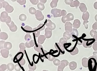 <p>What blood cell is this?</p>