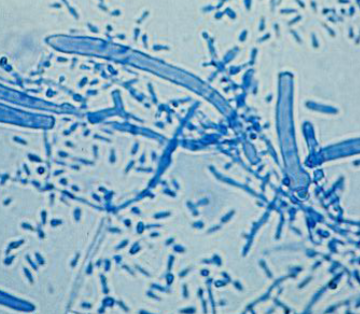 <p>microconidia: teardrop shaped<br>macroconidia: cigar shaped with thin walls</p>