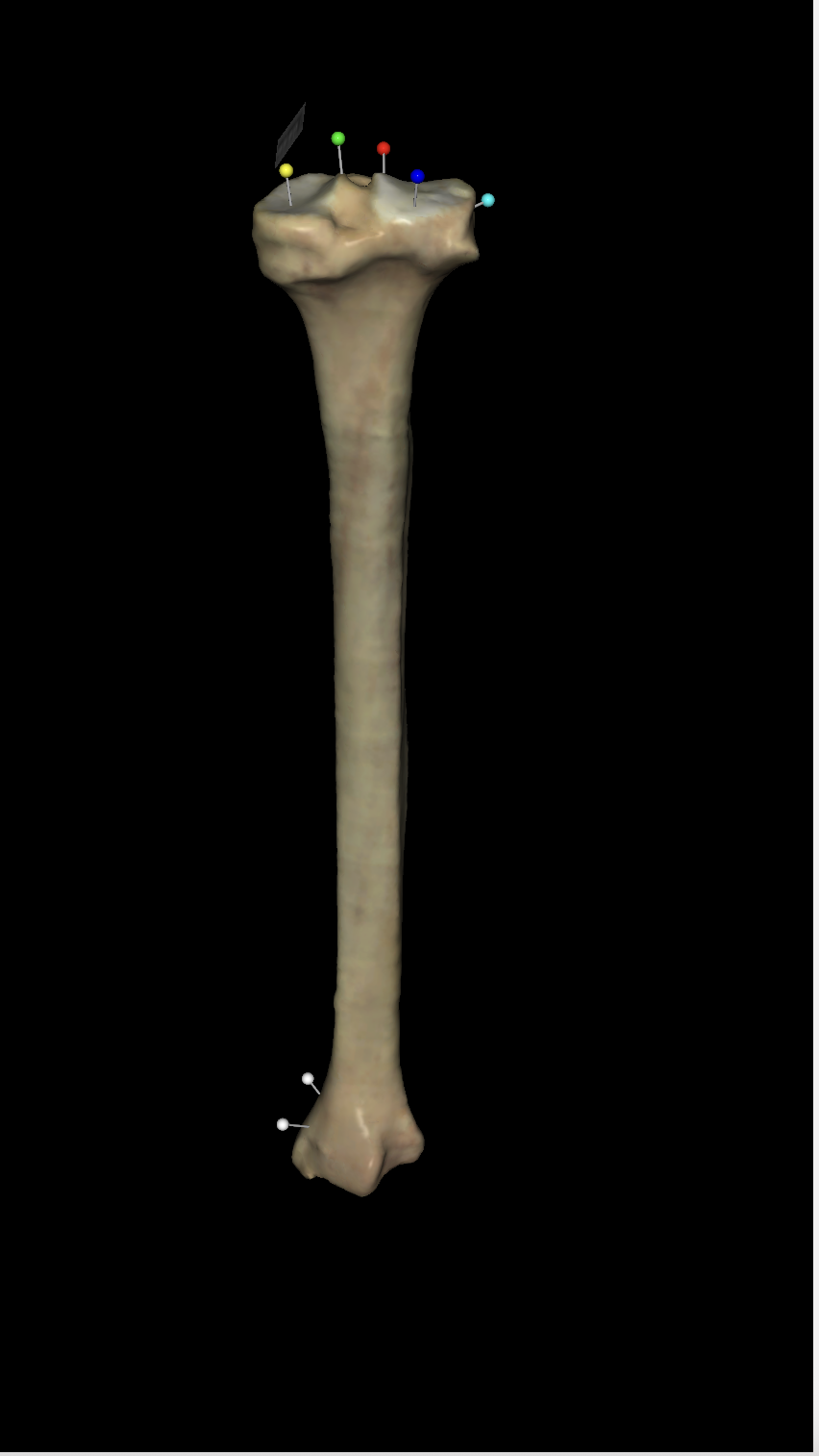 <p>On the right tibia what is the red tag located?</p>
