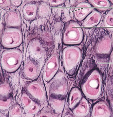 <p>what kind of tissue is this (cartilage)</p>
