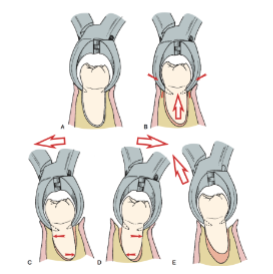 <p>• Apical pressure is used to expand the socket and to sink the teeth into the furcation</p><p>• A pumping motion may be used to extrude the tooth</p><p>• Buccal-lingual movement may also be incorporated to remove the tooth towards the buccal</p><p>• Tooth is delivered <strong>occlusally</strong></p><p>• Apical pressure is used to expand the socket</p>
