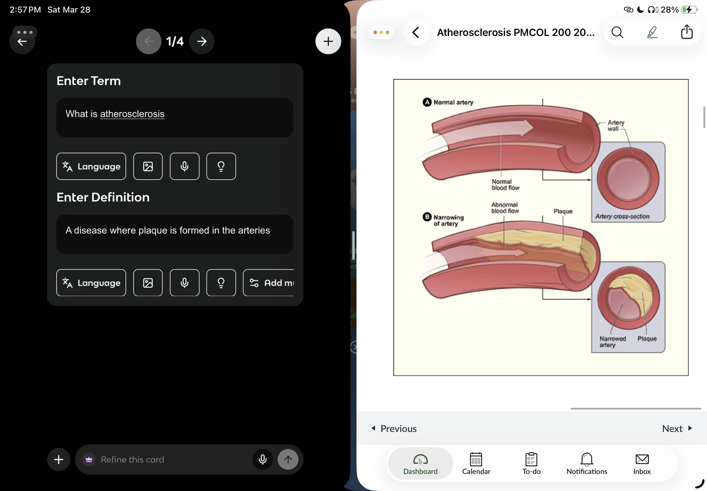 <p>A disease where plaque is formed in the arteries (reduced blood flow to organs) + plaque dislodgement and flow to other locations</p>
