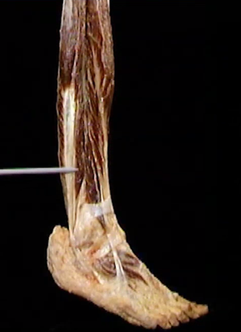 <p>Diep, boven voet</p>