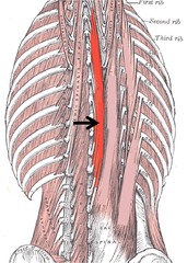 <p>Medial muscle of the erector spinae</p>