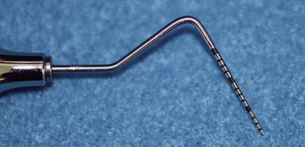 <p>Used to measure gum pockets</p>