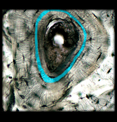 <p>concentric layer of matrix surrounding the central canal in bone</p>
