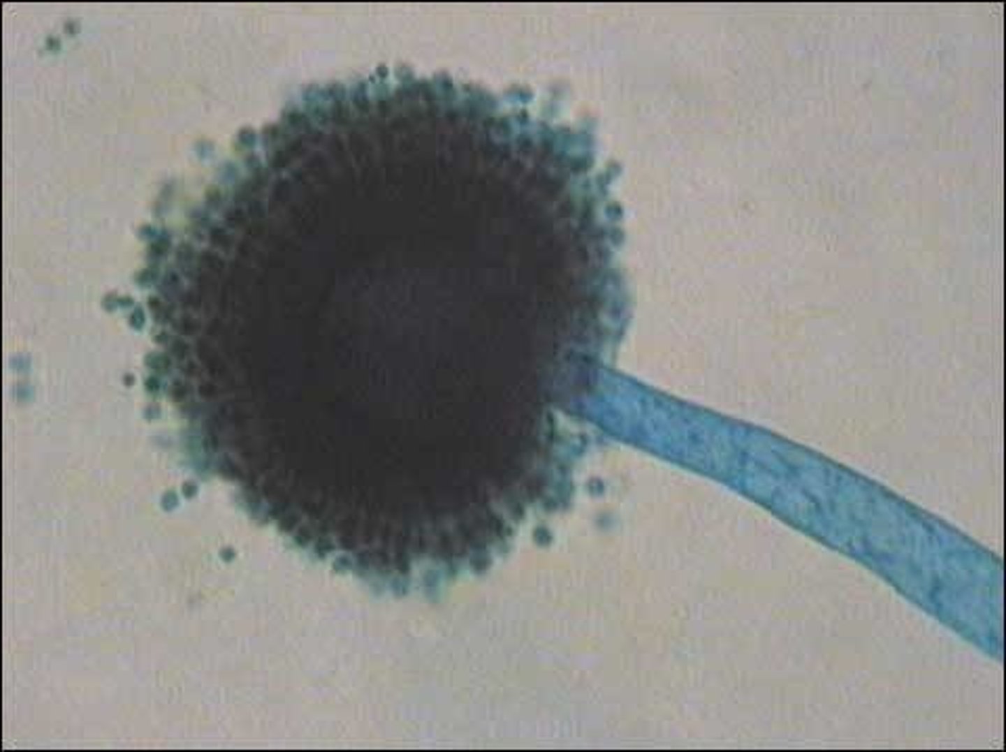 <p>Smooth conidiophores with spherical vesicles</p><p>Conidia are dark</p>