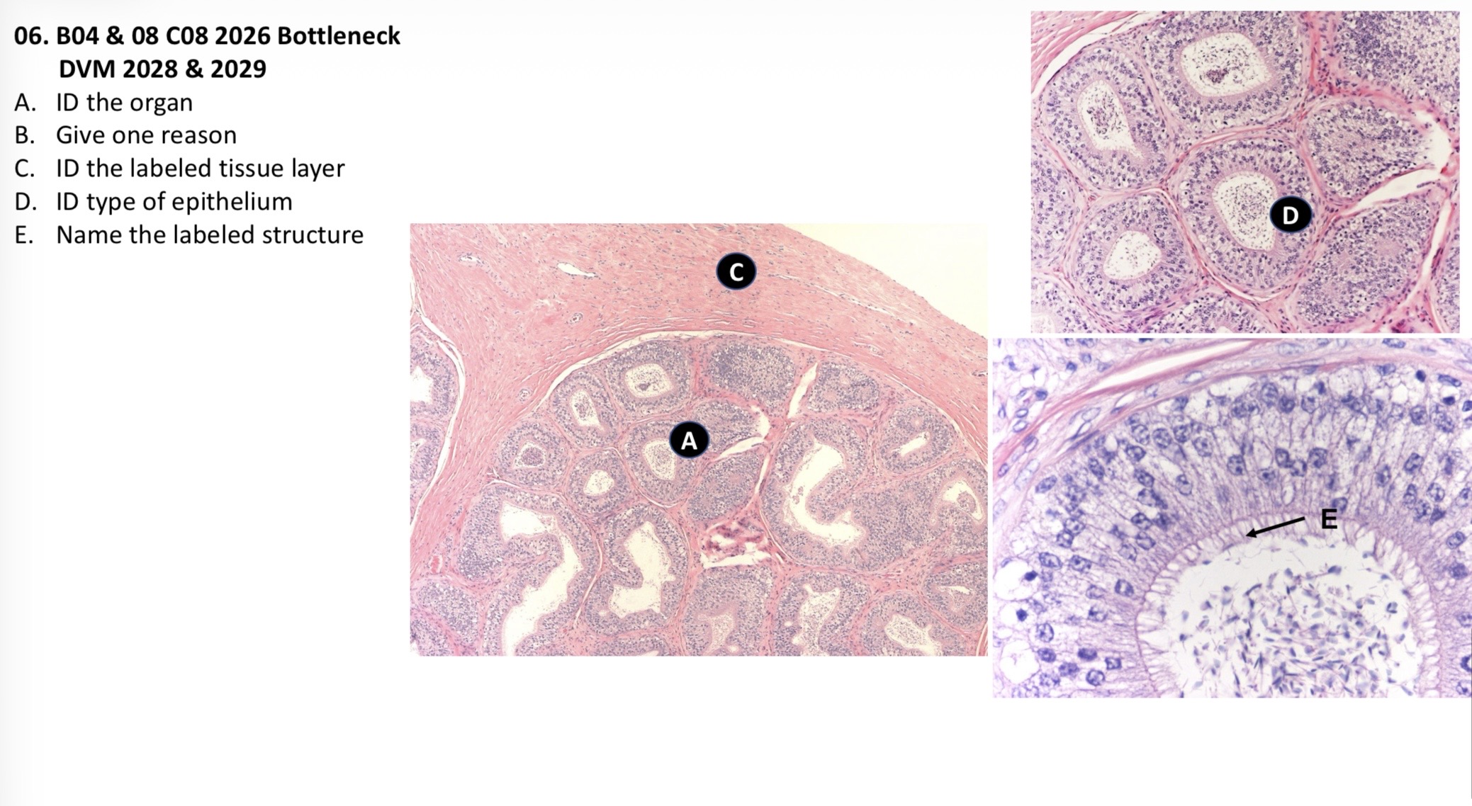 <p>A. Epididymis</p><p>B. Sperms within the lumen, pseudostratified ciliated columnar epithelium</p><p>C. Tunica albuginea</p><p>D. Pseudostratified ciliated columnar epithelium</p><p>E. Stereo cilia</p>
