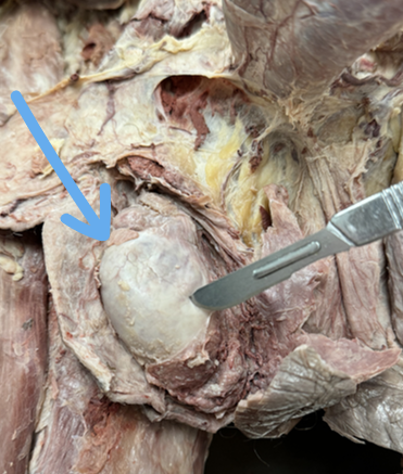 <p>visceral layer of tunical vaginalis</p>
