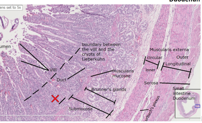 <p>crypts (of lieberkuhn)</p><p>brunners glands (looks like bowman’s glands)</p><p>muscularis mucosae </p><p>between crypt: lacteals, and villi on top of lacteal.</p><p>paneth cells at bottom of crypt</p>