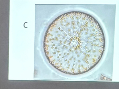 <p>What is this organism?</p>