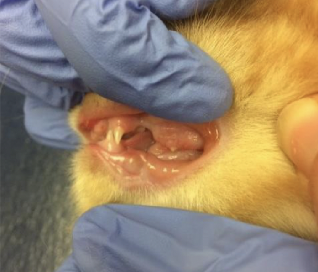 <p>What rare condition is related to dwarfism, with obstipation, megacolon, and delated dental eruption being primary presenting complaints leading to diagnosis, and treatment consisting of levothyroxine supplementation and gingivectomy?</p>