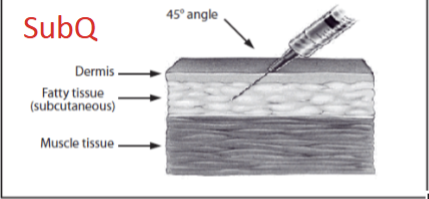 <ul><li><p>45 degree angle </p></li><li><p>under the skin </p></li></ul><p></p>