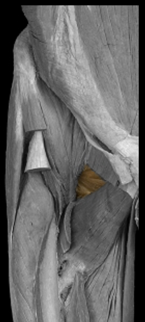 <p>function of obturator externus</p>