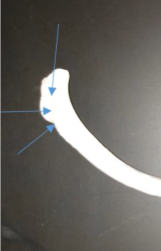 <p>What is this called (in between the top and bottom arrow)?</p>