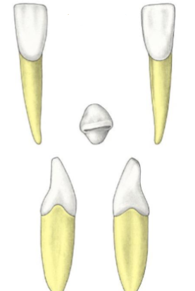 <p>Which tooth?</p>