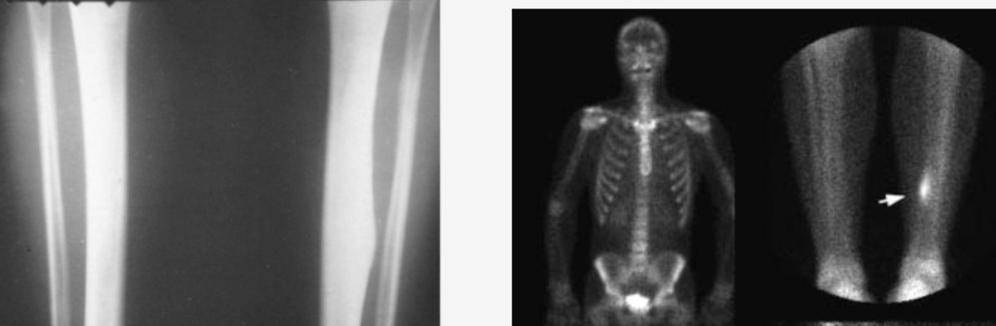 <p>what type of fracture?</p>