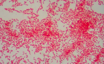 <p>gram positive or negative </p>