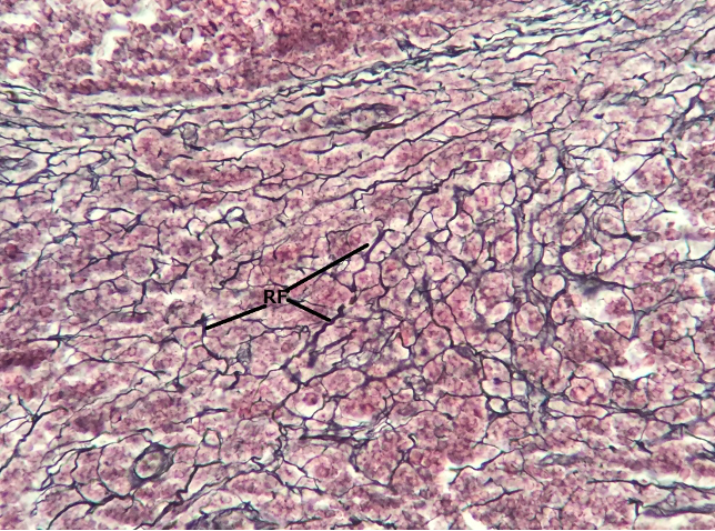 <p>spleen, dermis</p>