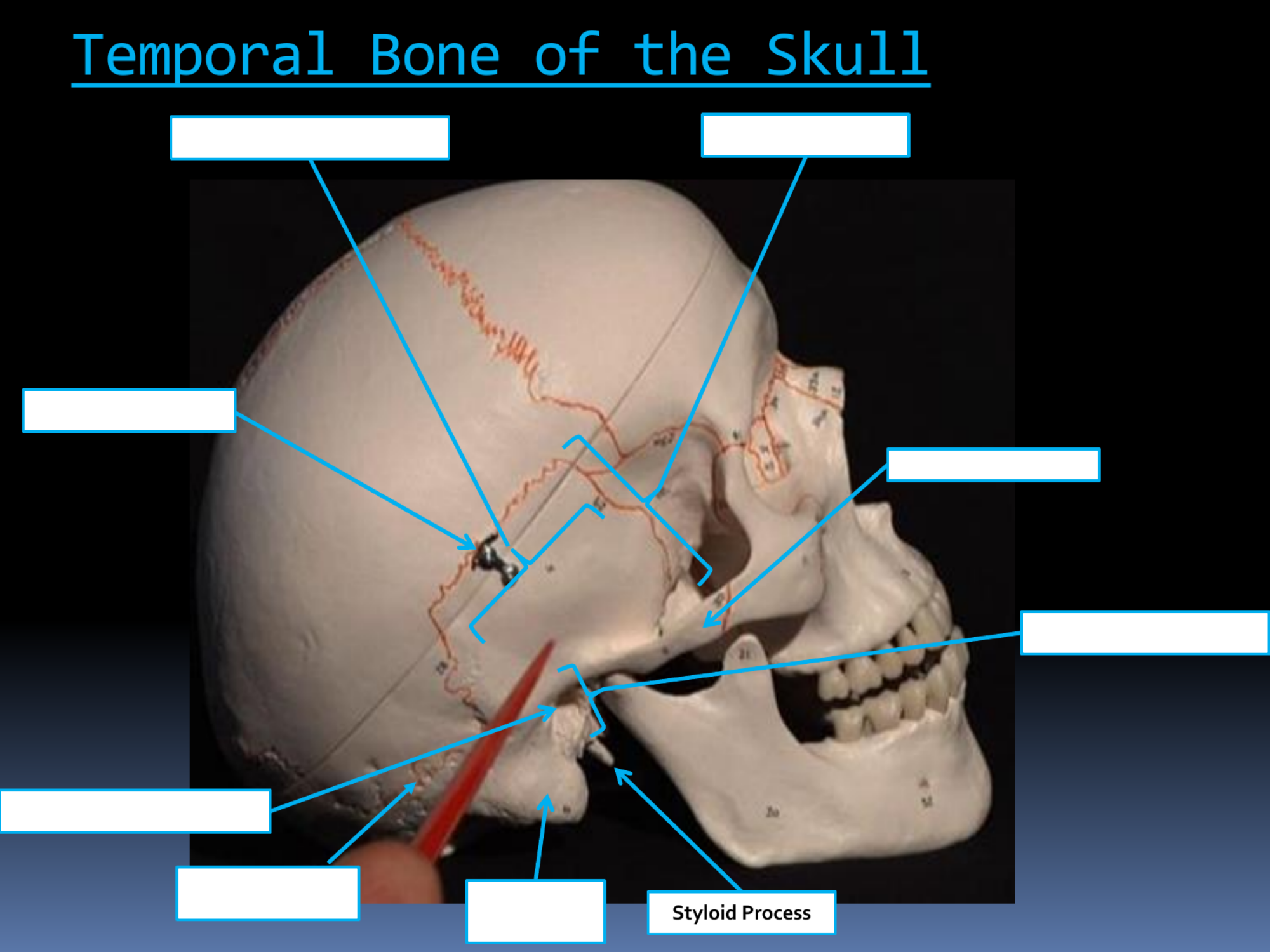 <p>Styloid Process</p>