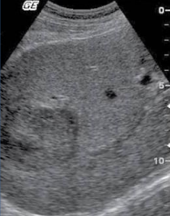 <p>what is being shown in this and its sonography</p>