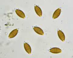 <p>What parasite is this?</p>