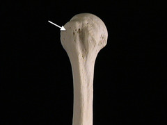 <p>In this view of the right humerus, identify the structure indicated by the arrow.</p>