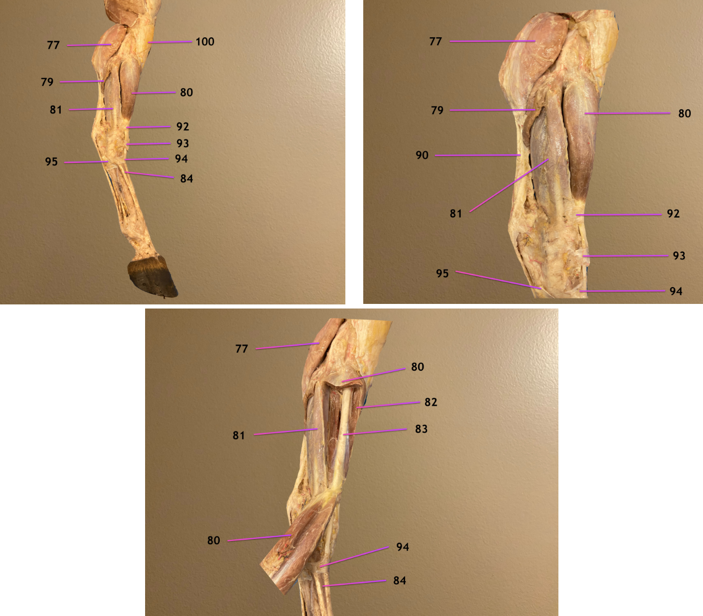<p>pic 1: lateral view of crus, cranial to rt</p><p>pic 2/3: same but zoomed in &amp; some muscles cut</p><p>.</p><p>label 83, 84, 90, 100</p>