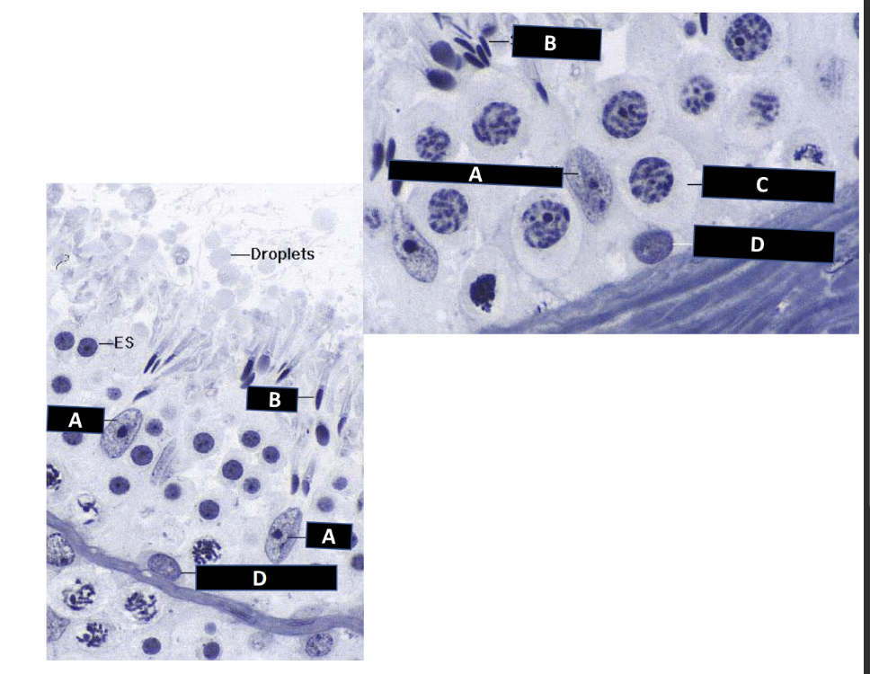 <p>A. ID the cell</p><p>B. ID the cell</p><p>C. ID the cell</p><p>D. ID the cel</p>