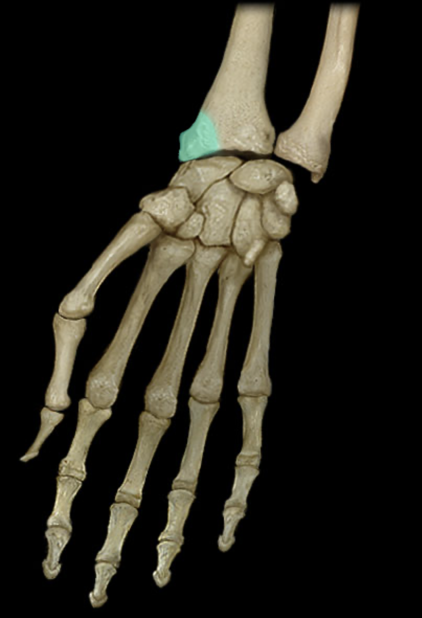 term image