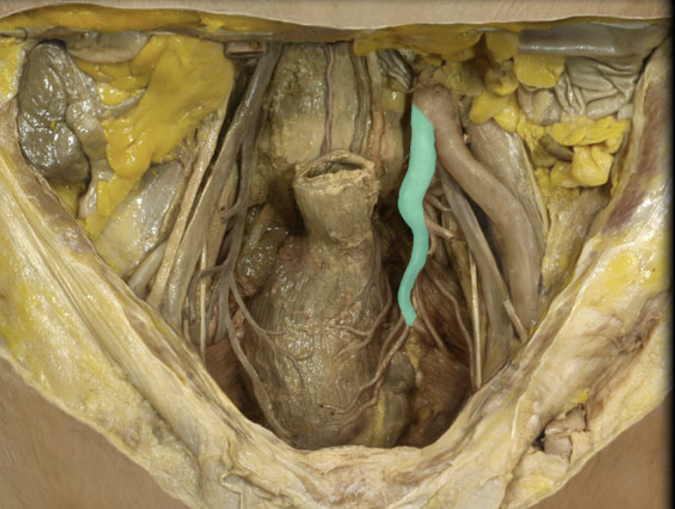 <p>Identify the feature of the abdominal aorta</p>