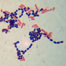 <p>Cocci (spherical), bacilli (rod-shaped), spirochetes (spiral).</p>