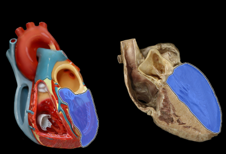 term image