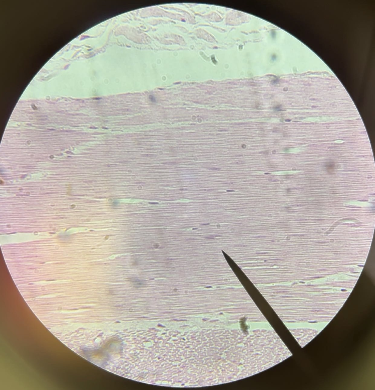 <p>tissue</p>