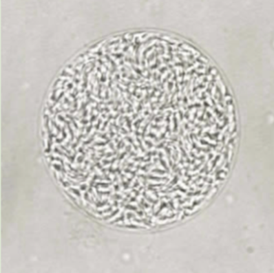 <p>genus, species, stage</p>