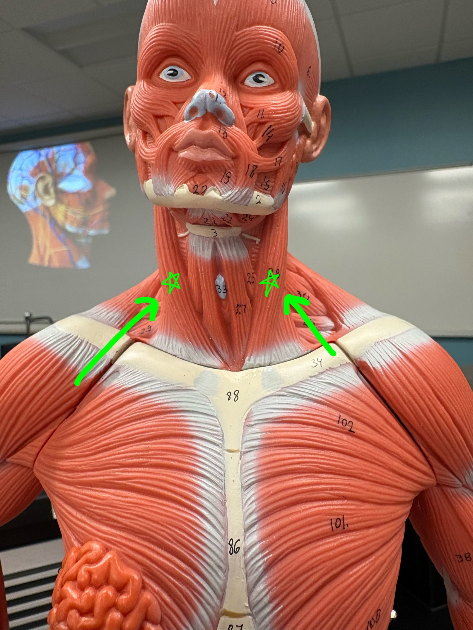 <p>Name the muscle.</p>